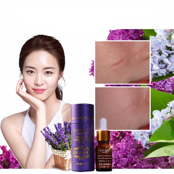 Scar Remover Healing Essential Oil
